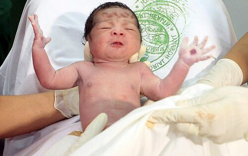 Phép lạ: Bé Sinh Ra