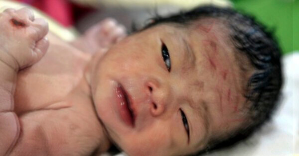 Phép lạ: Bé Sinh Ra